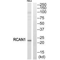 Anti-RCAN1