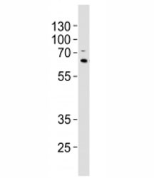 Anti-p62, clone 1336CT763.152.125