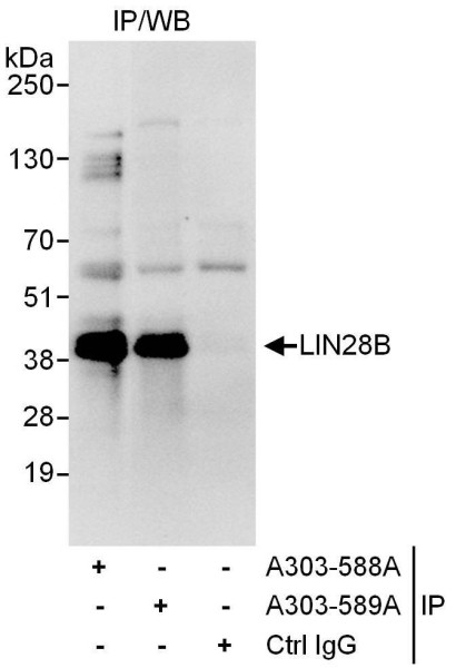 Anti-LIN28B