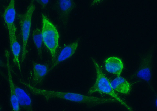 Anti-CD171/N-CAML1/L1CAM Monoclonal Recombinant Antibody