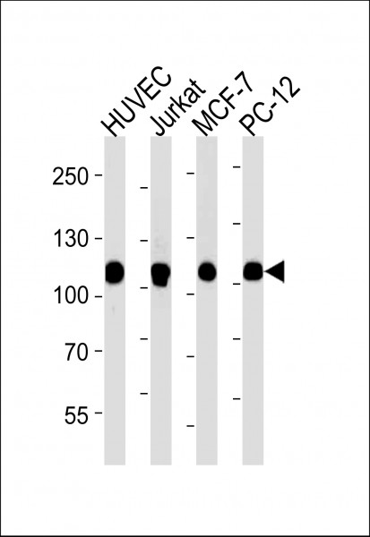 Anti-Topoisomerase I, clone 1291CT875.142.166