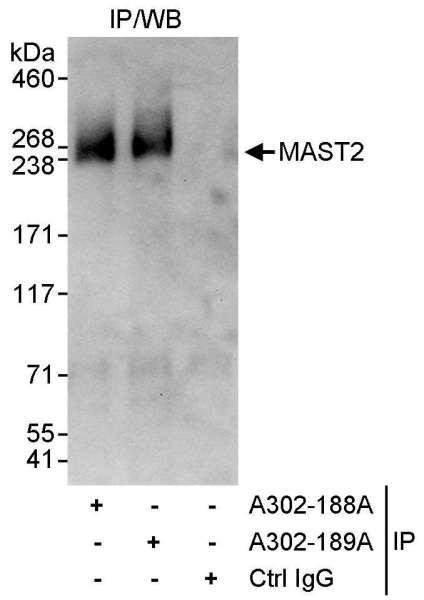 Anti-MAST2