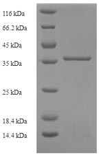 Complement component C8 gamma chain (C8G), human, recombinant