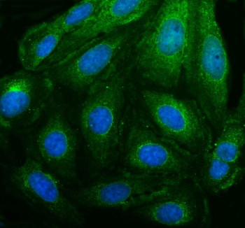 Anti-PEX14 / Peroxisomal biogenesis factor 14