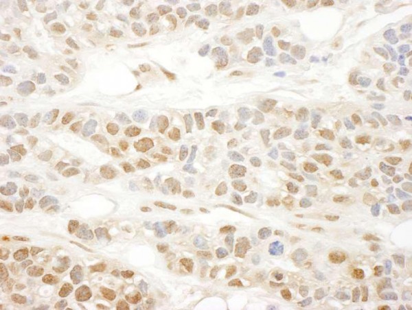 Anti-MKL1 (IHC)