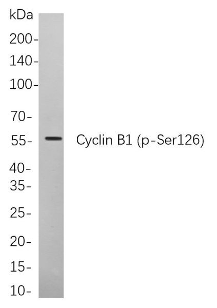 Anti-Recombinant Phospho-Cyclin B1 (Ser126), clone 11A13