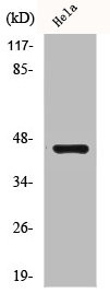 Anti-CSNK2A1