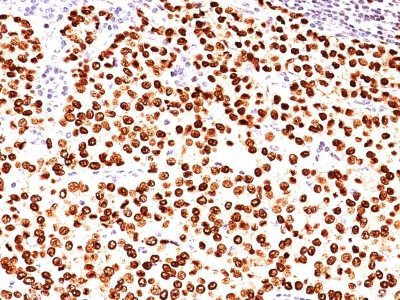 Anti-PLGF(PLGF93), CF568 conjugate, 0.1mg/mL