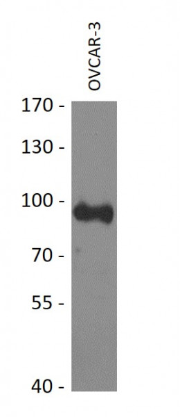 Anti-KIF2C / MCAK