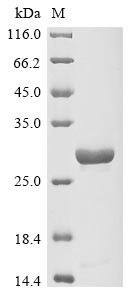 Virulence plasmid protein pGP3-D, Chlamydia trachomatis, recombinant