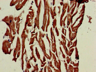 Anti-PHOSPHO1