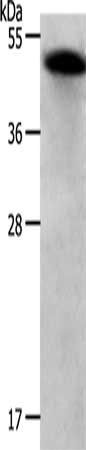 Anti-RBMS1