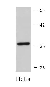 Anti-MC1R