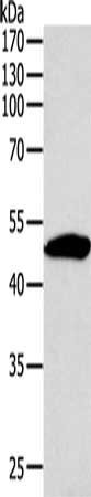 Anti-SIRT6