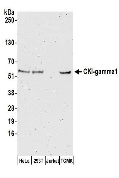 Anti-CKI-gamma1