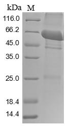 Pyruvate kinase PKM (Pkm), rat, recombinant