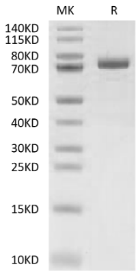 ANGPTL7/CDT6 hFc Chimera, Human