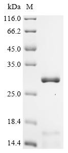 Metaxin-1 (MTX1), partial, human, recombinant