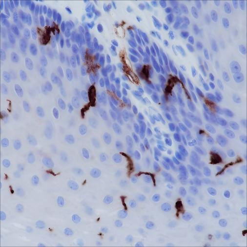 Anti-Recombinant CD1a, clone A163