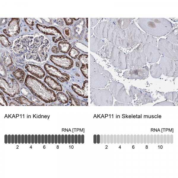 Anti-AKAP11