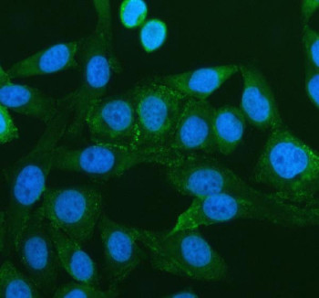 Anti-PEX16 / Peroxisomal biogenesis factor 16