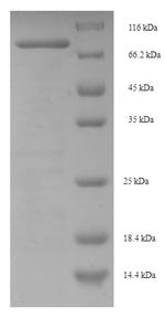 Centrosomal protein of 63KDA (CEP63), human, recombinant