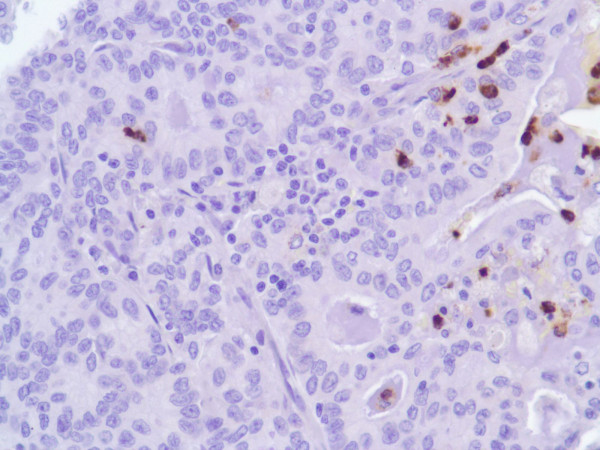 Anti-Myeloperoxidase (MPO), clone SP72