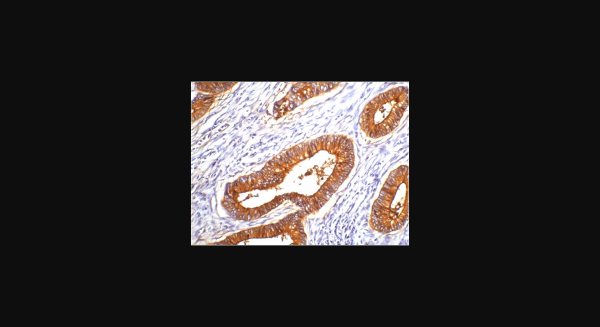 Anti-Carcinoembryonic Antigen/CEA, monoclonal