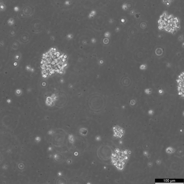 B-LCL-CDG7 Cells