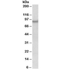 Anti-NPAS4