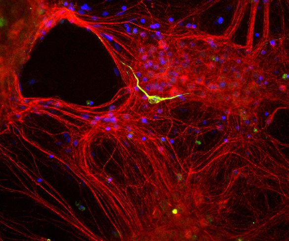 Anti-Alpha Internexin / NF-66