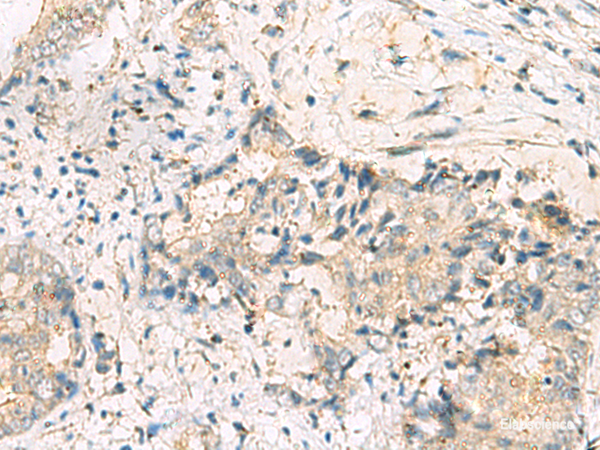 Anti-MGAT4B