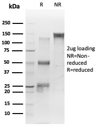 Anti-TDP43 / TARDBP / TAR DNA binding protein, clone TARDP/349