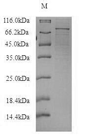 RNA exonuclease 4 (REXO4), human, recombinant