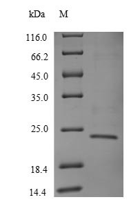 T cell receptor beta constant 1 (TRBC1), partial, human, recombinant