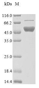 Flap endonuclease 1 (FEN1), human, recombinant