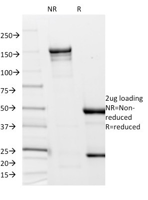 Anti-Borrelia burgdorferi (p41 Flagellin)(6802), CF405S conjugate, 0.1mg/mL