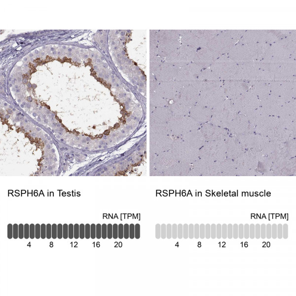 Anti-RSPH6A