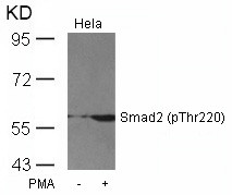 Anti-phospho-Smad2 (Thr220)