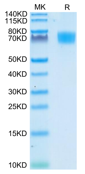 Human ALCAM/CD166 Protein