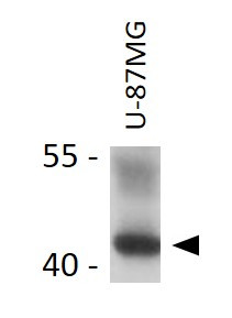 Anti-CHI3L1