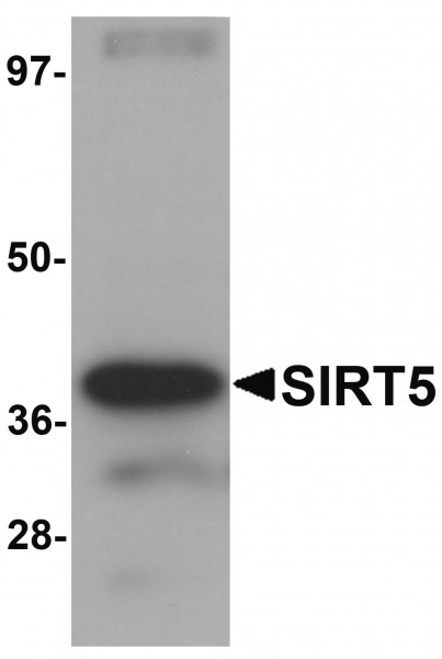 Anti-SIRT5