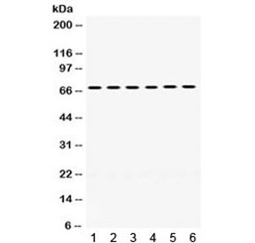 Anti-PDPK1 / 3-phosphoinositide-dependent protein kinase 1