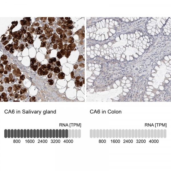 Anti-CA6