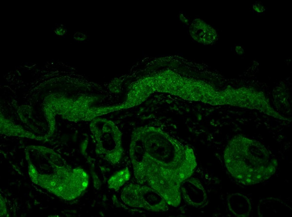 Anti-Hsp70 / Hsc70, clone N27F3-4
