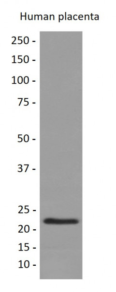 Anti-Placental Lactogen