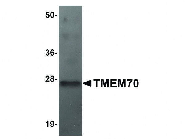 Anti-TMEM70