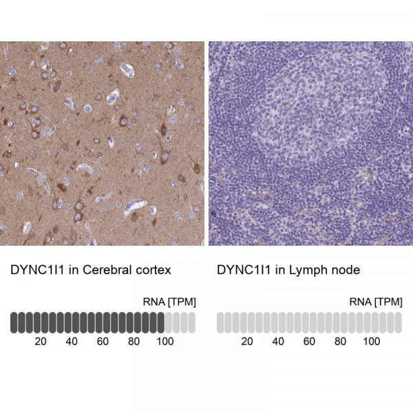 Anti-DYNC1I1
