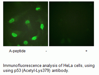 Anti-p53 (Acetyl-Lys379)