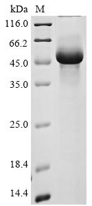 Transmembrane protease serine 11A (TMPRSS11A), partial, human, recombinant